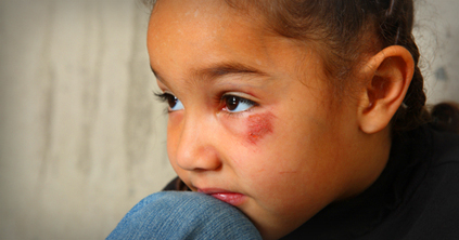 Child Physical Abuse