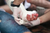 Common Myths About Personal Injury Law Debunked